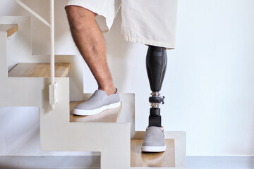 Man amputee with prosthetic leg disability on above knee transfemoral leg prosthesis artificial device stands on feet on stairs, close up. People with amputation disabilities everyday life. - obrazy, fototapety, plakaty