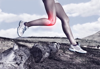 Legs of woman running, red and knee pain with overlay, fitness and health with injury, bone and medical emergency. X ray, anatomy and skeleton with female runner outdoor, inflammation and sprain