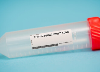 Transvaginal mesh scan