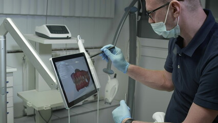 A professional dentist man looks at a 3d model of teeth on a computer monitor. Dental consultation, diagnostics. Jaw scan, digital imprint, medical digital technology