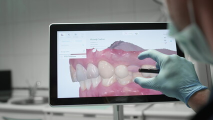 A professional dentist man looks at a 3d model of teeth on a computer monitor. Dental consultation, diagnostics. Jaw scan, digital imprint, medical digital technology