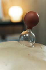 Cupping massage therapy, silicone cupping, close up on female back in clinic center