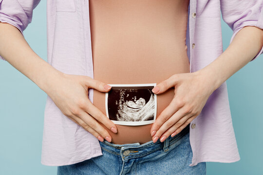 Cropped young pregnant future mom woman with belly tummy wearing casual clothes holding show ultrasound image pregnant baby photo isolated on plain pastel blue background. Maternity pregnancy concept.