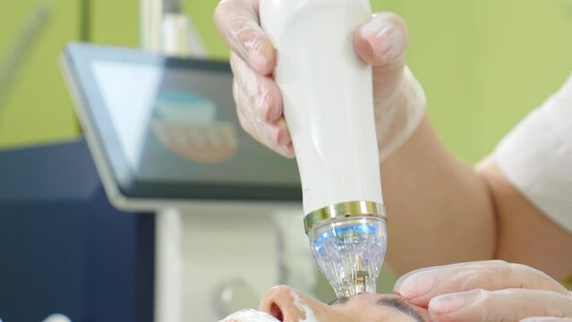 Fractional microneedle RF lifting procedure in beauty clinic. Hardware cosmetology. Close up. Beautician making facial rejuvenation treatment. Skincare anti-age concept. Cosmetologist. 4 k video