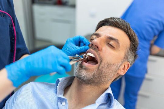Treatment of a patient with a dentist surgeon. Extraction of teeth and prosthetics. Doctor performing extraction procedure with forceps removing patient tooth. Healthcare dentistry medicine concept