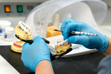 Dental prosthesis work. Teeth painting. - obrazy, fototapety, plakaty