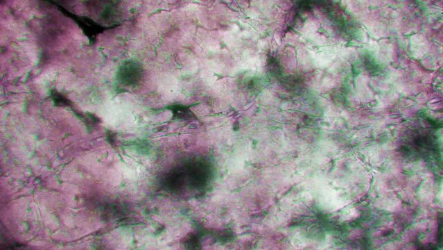 capillaries and erythrocytes at microscope, blood , time lapse