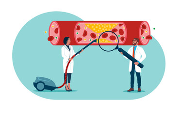 Cleansing blood vessels and veins from cholesterol and blood cells clot. Modern vector illustration in flat style