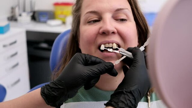 Dentist hand holding teeth color samples helping patient to choose color for veneer treatment and whitening 
