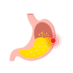 An unhealthy stomach, Nutrition, stomach pain, bloating. Human internal organs symbol. Digestive system anatomy. isolated on white background. Vector illustration