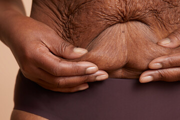 Fototapeta premium Close-up view of senior woman touching wrinkled belly