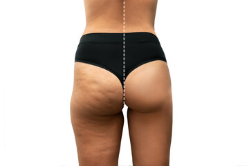 Young tanned woman's thighs and buttocks with cellulite before after treatment and sports isolated on a white background. Getting rid of excess weight. Result of diet, massage. Improving skin on legs - obrazy, fototapety, plakaty