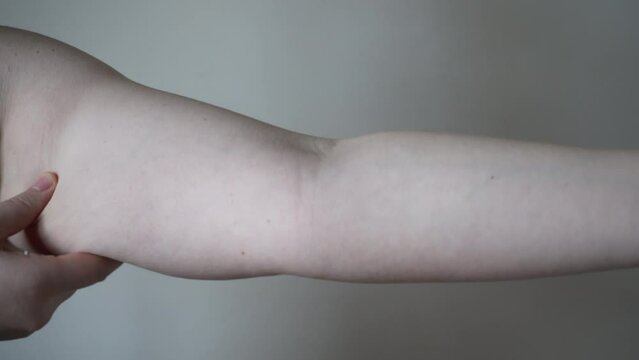 Light-skinned young woman with drooping arms. Sad bad body shape girl. fat on the arms, not inflated biceps, sagging skin. 4k video. Fat, fat arms with excess weight.