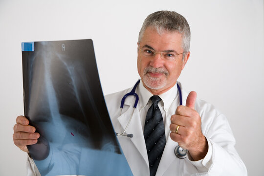 Doctor with a thumbs up after evaluating an x-ray