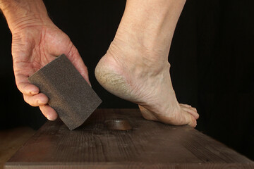 A man's hand holds a rough brush next to a heel covered with cracked skin.  An example of home foot...