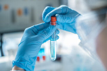 Photograph shows a healthcare worker performing blood test in a chemical laboratory to identify...