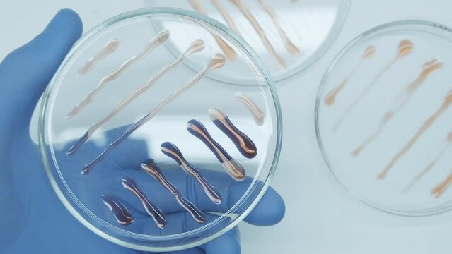 Bacteria culture growth on a petri dish in microbiology lab. Candida auris. Closeup of bacteria culture growth on selective media plate in microbiology laboratory. Biomarker. Bio-reagent.