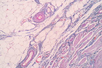 Histological Uterus human, Uterine tube human, Placenta human and Umbilical cord Human under the microscope for education.
