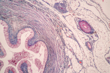 Histological Uterus human, Uterine tube human, Placenta human and Umbilical cord Human under the...