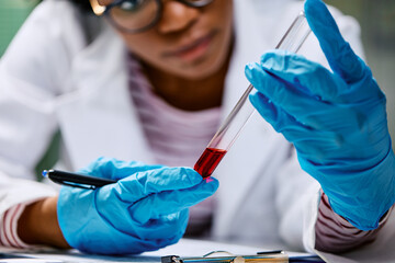 Close up of female lab technician analyzing liquid in test tube.