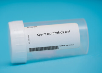 Fototapeta na wymiar Sperm morphology test