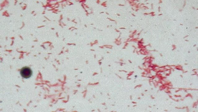 Bacteria cells under a microscope, bacteria magnified 1000 times.