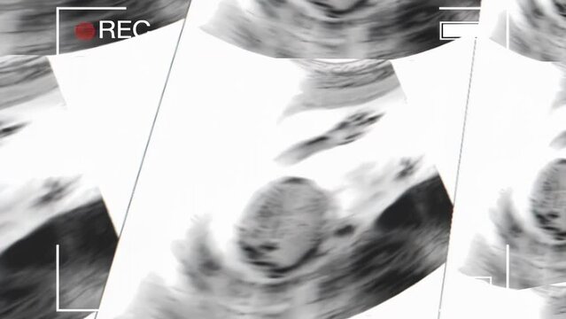 Recording a mother's womb ultrasound during pregnancy. Ultrasound of a fetus at 12 weeks