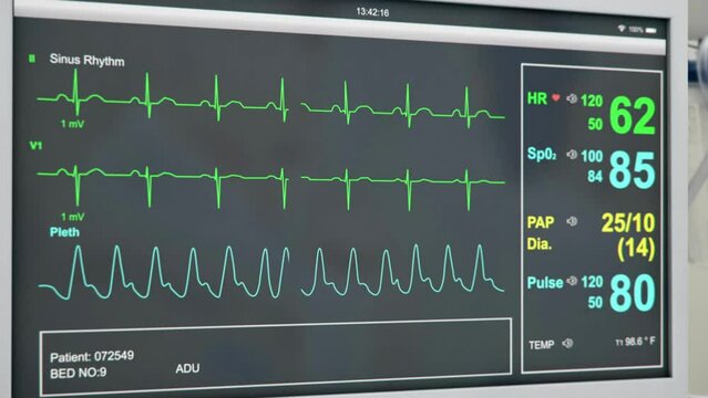 ekg heart monitor hospital medical check up line computer 4k HD.