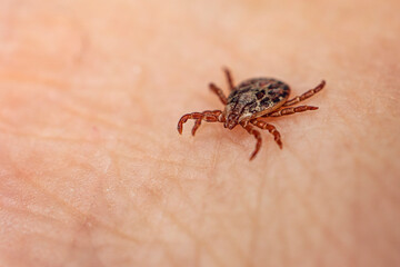 dangerous blood-sucking insect. small brown spotted mite, biological name Dermacentor marginatus on human skin. Tick on the skin background. macrophoto