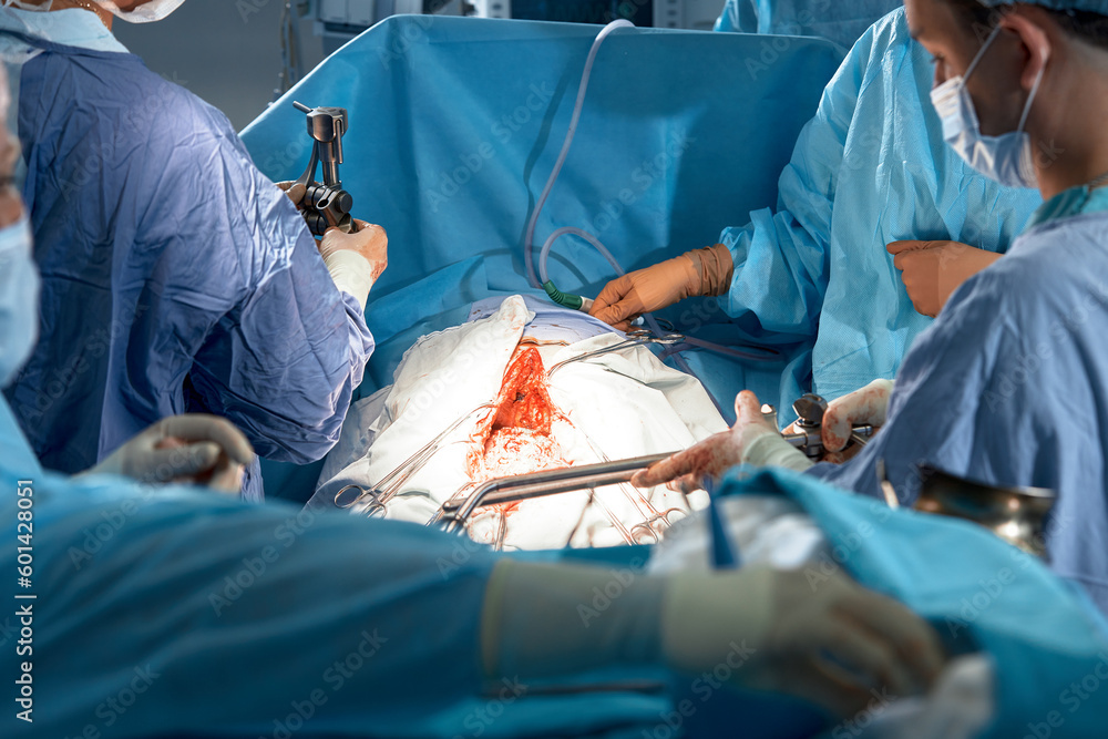 Aufkleber team of surgeons carefully performing surgery using precise instruments in the operating room save t