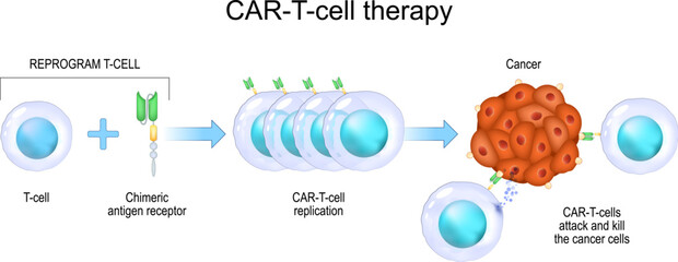 CAR T-cell therapy. cancer immunotherapy. - obrazy, fototapety, plakaty