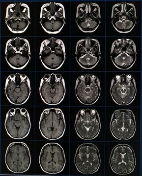 Mri image of human brain