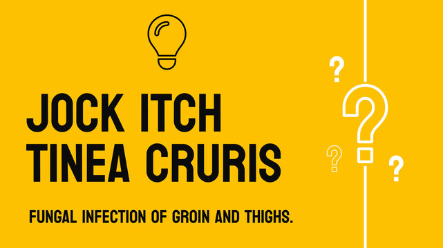 Jock Itch Tinea Cruris: A fungal infection in the groin area.