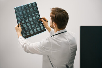 Doctor analyzes examines an MRI scan of the brain