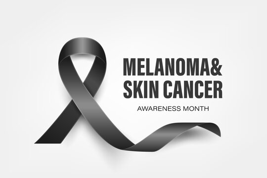 Melanoma, Skin Cancer Banner, Card, Placard with Vector 3d Realistic Black Ribbon on White Background. Melanoma, Skin Cancer Awareness Month Symbol Closeup, May. World Melanoma Day Concept