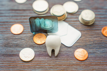 Dental Expenses Concept with Tooth Model, X-ray, and Coins