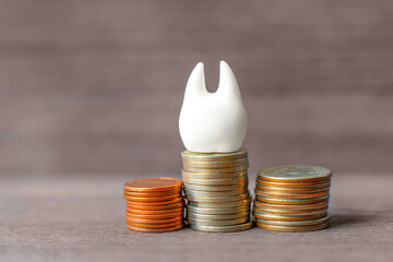Tooth Model and Coins Stacks on a Wooden Table