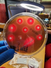 Streptococcal bacterial colonies on blood agar culture plates