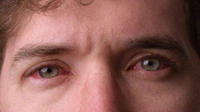 Man with pink eye looks towards camera and blinks - close up on eyes