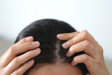 A woman has problems with hair and scalp,she has dandruff from allergic reactions to shampoos. and hair conditioner
