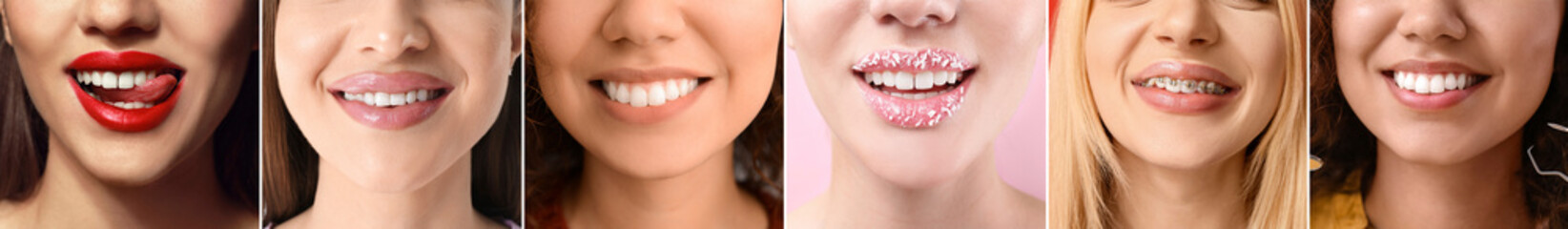 Collage of many women with healthy teeth, closeup