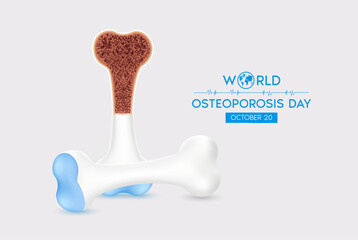 World Osteoporosis Day. Human bone anatomy. Unhealthy bone joint on a white background. Poster or banner for website. Medical or healthcare concept. Realistic 3d Vector illustration.