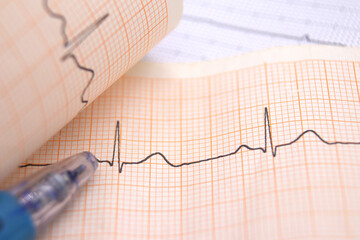 heart rhythm ekg note on paper doctors use to analyze heart disease treatment illustration on a white background