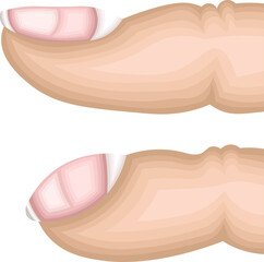 ばち指　イラスト