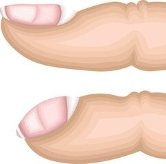 ばち指　イラスト