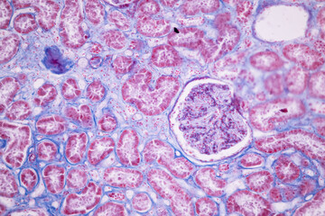 Histological Pancreas human, Liver human, Vermiform appendix human and Kidney Human under the microscope for education.