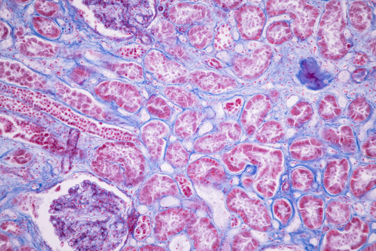 Histological Pancreas human, Liver human, Vermiform appendix human and Kidney Human under the microscope for education.