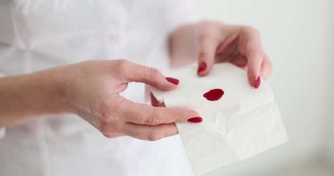 Woman holds paper tissues with blood stain in light premise. Female person shows napkin with red spot in flat room. Bleeding wound and body injury result slow motion