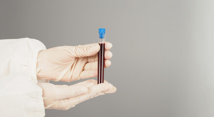 The hand is holding a blood test tube on grey background. Hand wears white latex glove.