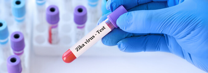 Fototapeta premium Doctor holding a test blood sample tube with Zika virus test on the background of medical test tubes with analyzes. Banner.